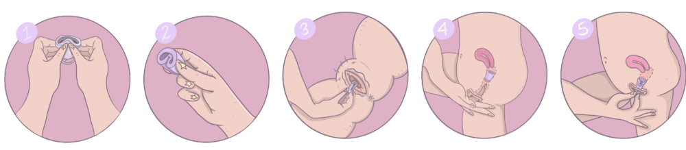 BEPPY - PACK DE 2 COPAS MENSTRUALES + 2 BOLSAS PARA GUARDAR + 1 BOLSITO/NECESER LIMPIADOR DE SILICONA - Imagen 2